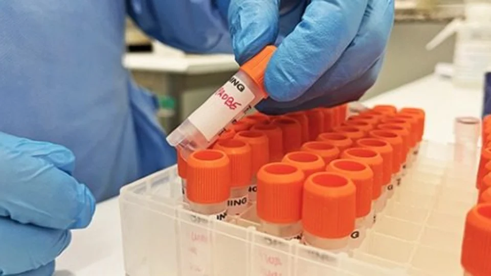 Semsa orienta unidades de saúde pública e privada sobre sintomas da varíola dos macacos, em Manaus