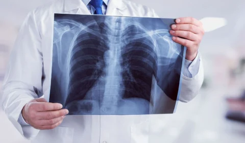Pneumonia e tuberculose provocam 240 mortes no 1º bimestre, no AM