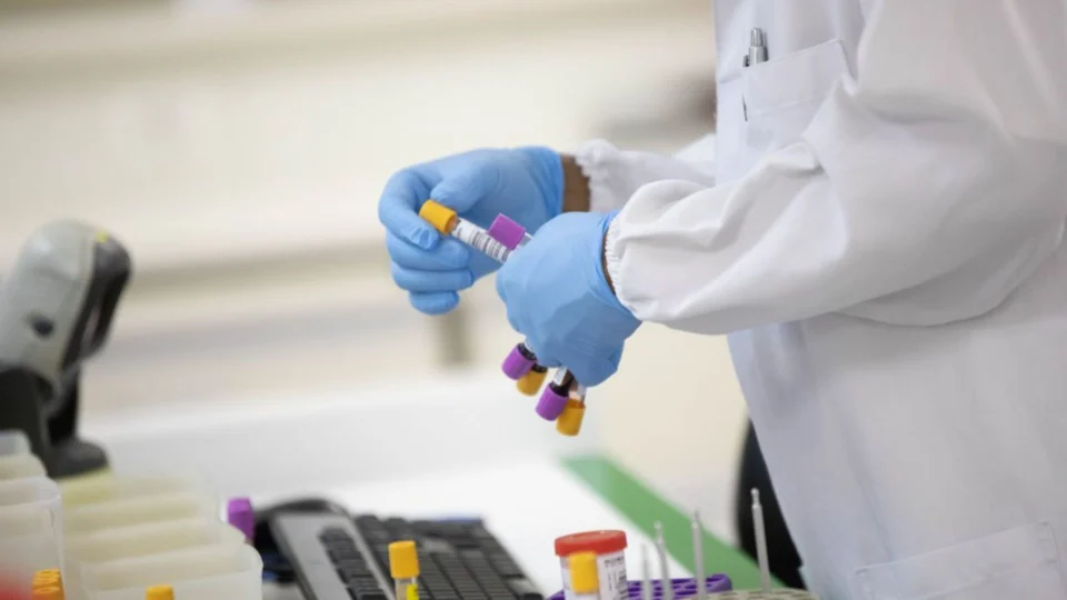 Monkeypox: sobe para 89 número de casos confirmados da varíola dos macacos no AM