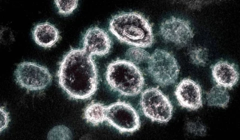 Coronavírus: nova subvariante é identificada em São Paulo