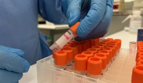 Monkeypox: AM contabiliza 173 casos confirmados e outros 74 em investigação