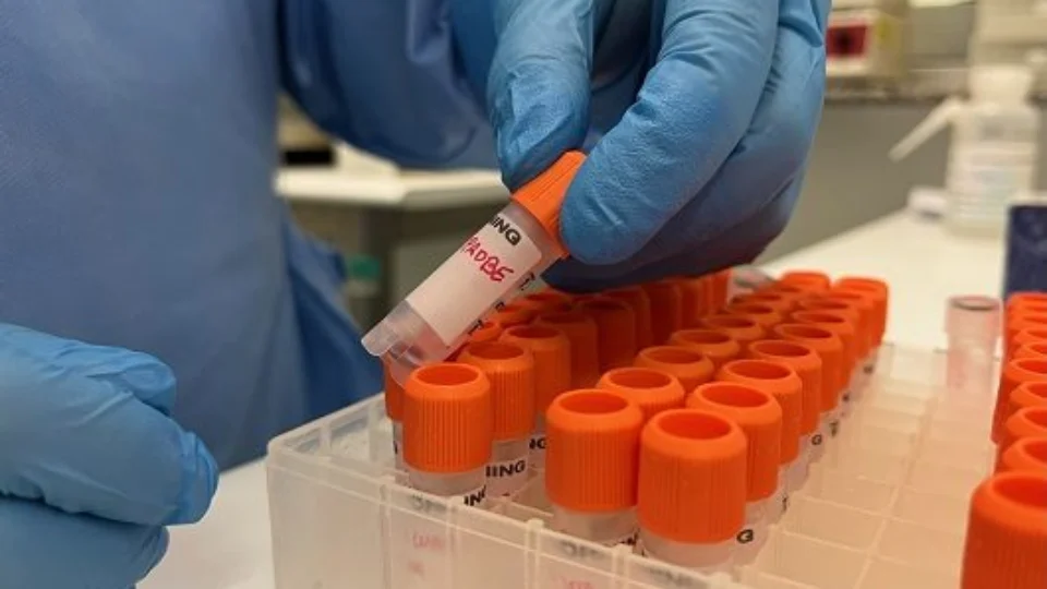 Monkeypox: sobe para 111 número de casos confirmados da varíola dos macacos no AM