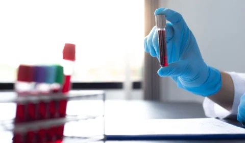 Monkeypox: sobe para 97 número de casos confirmados da varíola dos macacos no AM