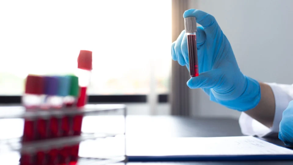 Monkeypox: sobe para 97 número de casos confirmados da varíola dos macacos no AM