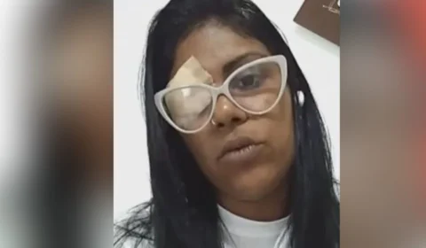 Mulher perde visão do olho direito após agressor se irritar com samba em homenagem a Exu, no RJ