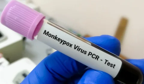 Monkeypox: Brasil investirá R$ 3 milhões em pesquisa sobre varíola dos macacos