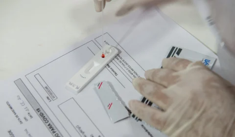 Boletim Covid-19: sexta-feira (17) registra 132 novos casos e nenhuma morte no AM