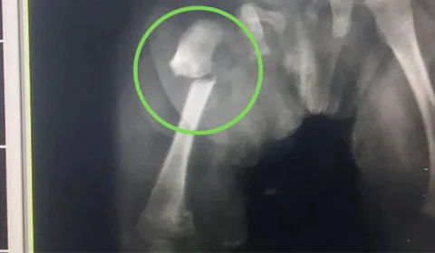 Bebê de três meses morre no RJ após sofrer agressões do pai; mãe é acusada de omissão