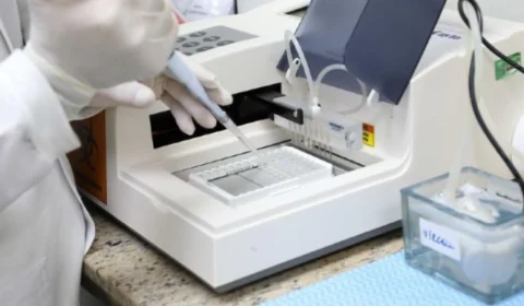 Amazonas registra 16 casos de Covid e nenhuma morte, neste sábado