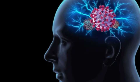 Covid-19 pode envelhecer cérebro em até 20 anos, diz estudo