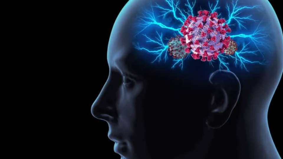 Covid-19 pode envelhecer cérebro em até 20 anos, diz estudo