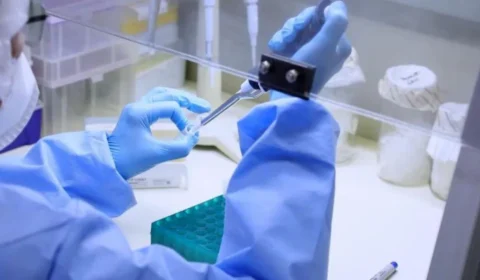 Descartados: dois casos notificados no AM não preenchem definição de caso suspeito para monkeypox, diz FVS