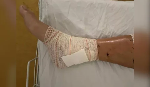 Triatleta é atacado por vários pitbulls e leva mais de 50 mordidas durante treino, em SP