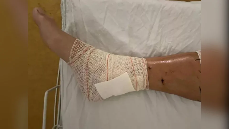 Triatleta é atacado por vários pitbulls e leva mais de 50 mordidas durante treino, em SP