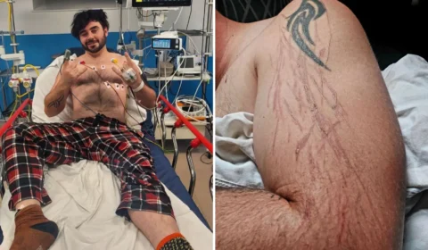 Homem é atingido por raio jogando videogame em casa e sobrevive, na Inglaterra