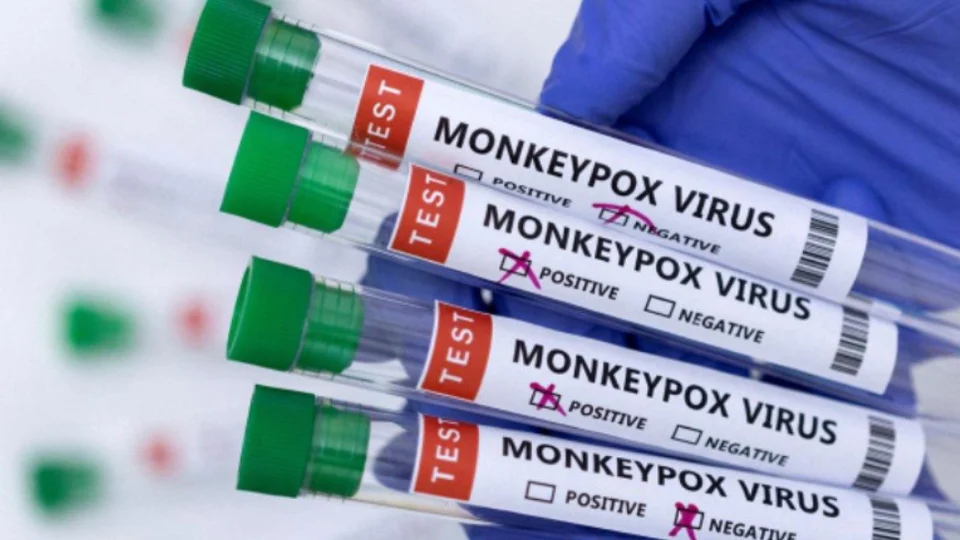 Vacina contra varíola dos macacos deve ser aplicada a pessoa exposta à contaminação