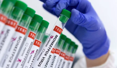 Varíola dos Macacos: Ministério da Saúde diz que controle da doença é prioridade no Brasil