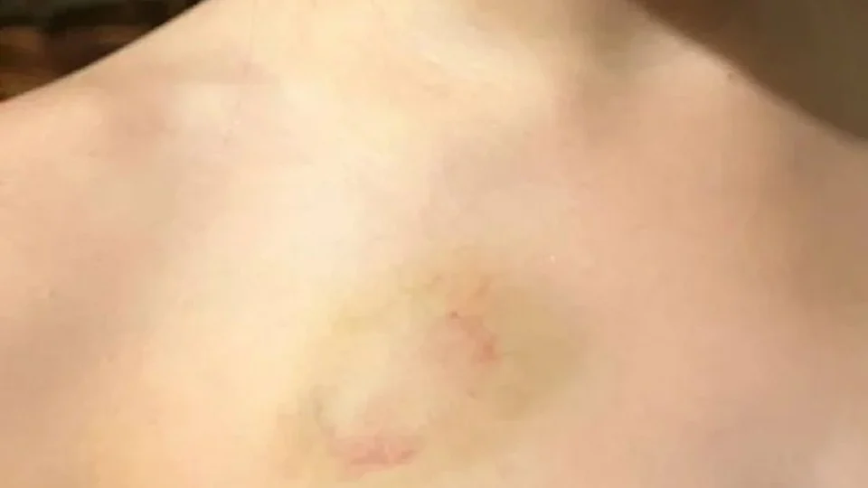 Advogado morde filha de 6 anos e ação vira caso de polícia em Brasília