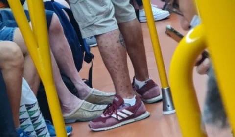 Médico flagra homem infectado com varíola dos macacos em metrô de Madri