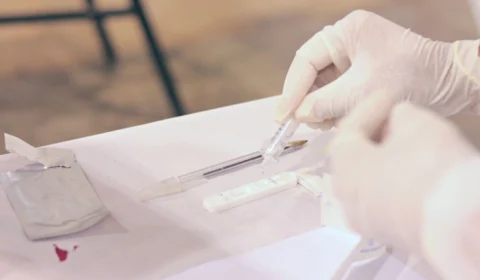 Amazonas registra 634 novos casos de Covid-19 e nenhuma morte neste sábado