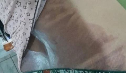 Homem que jogou água quente nas costas de companheira é preso, em Manaus