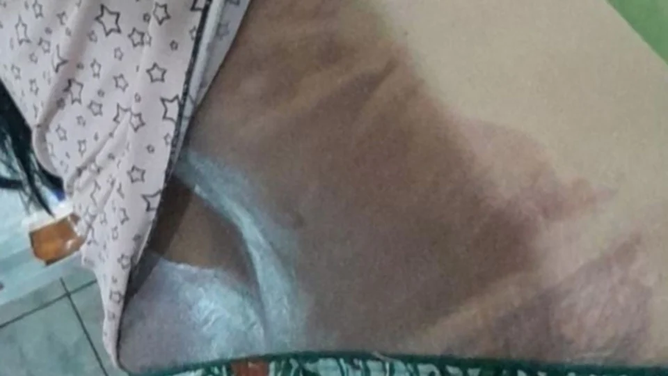 Homem que jogou água quente nas costas de companheira é preso, em Manaus