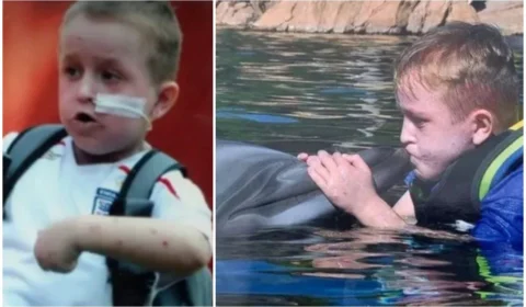 Menino mais alérgico do mundo morre aos 20 anos na Inglaterra: ‘Ele só queria viver uma vida normal’