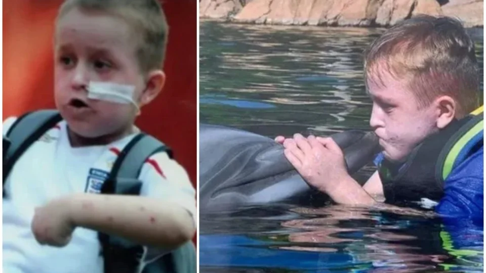 Menino mais alérgico do mundo morre aos 20 anos na Inglaterra: ‘Ele só queria viver uma vida normal’