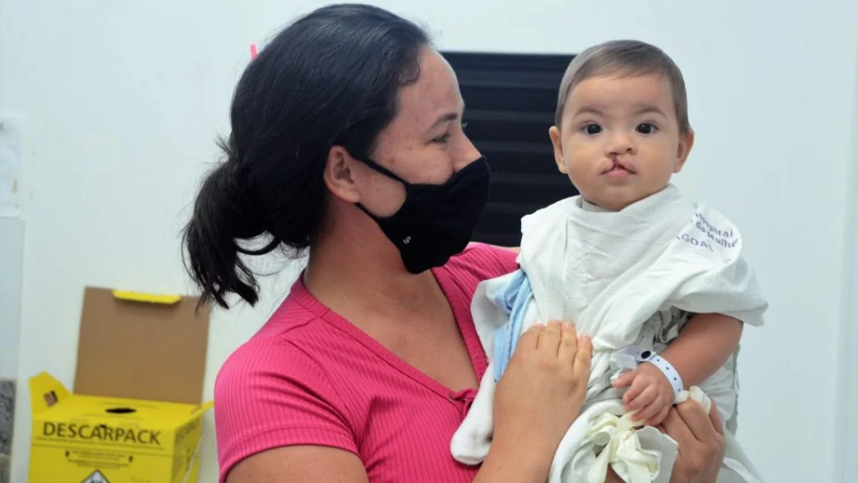 Avança proposta que obriga SUS oferecer plástica e pós-cirúrgico de lábio leporino