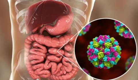 Amazonas registra morte de 20 crianças por diarreia aguda, a ‘GECA’, no início de 2022