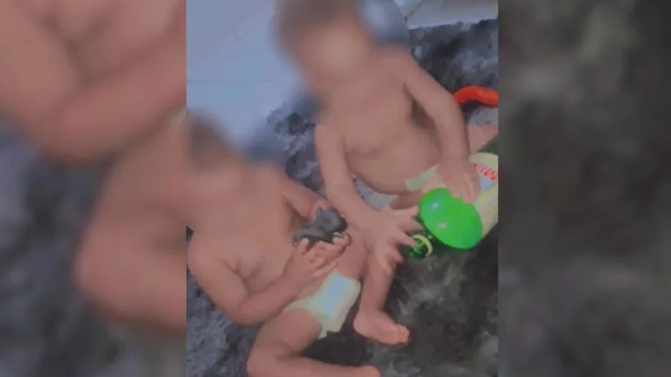 Caso raro: jovem tem filhos gêmeos de pais diferentes em Goiás