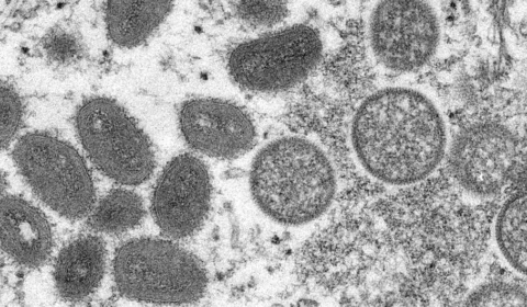 Sobe para  813 número de casos de Monkeypox no Brasil