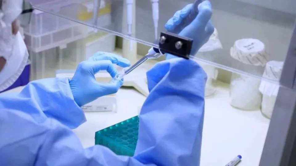 Monkeypox: AM contabiliza 167 casos confirmados e outros 64 em investigação