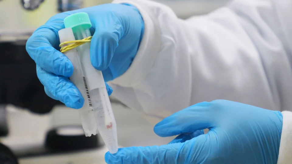 Varíola dos macacos: sobe para 213 número de casos confirmados no Amazonas