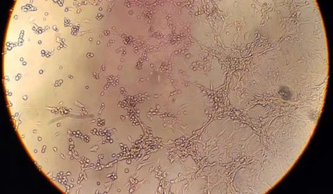 Monkeypox: AM contabiliza 208 casos confirmados e outros 69 em investigação