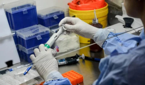 Sobe para 147 número de casos confirmados da varíola dos macacos no AM