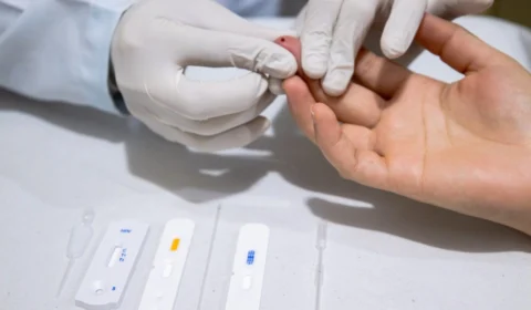 Rio de Janeiro registra aumento de 14% em casos de sífilis de 2020 para 2021