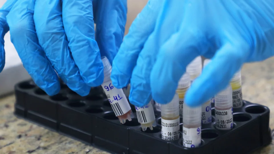 Monkeypox: Amazonas contabiliza 267 casos confirmados da doença