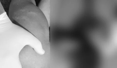 Idoso de 62 anos é executado a tiros em via pública na Zona Leste de Manaus