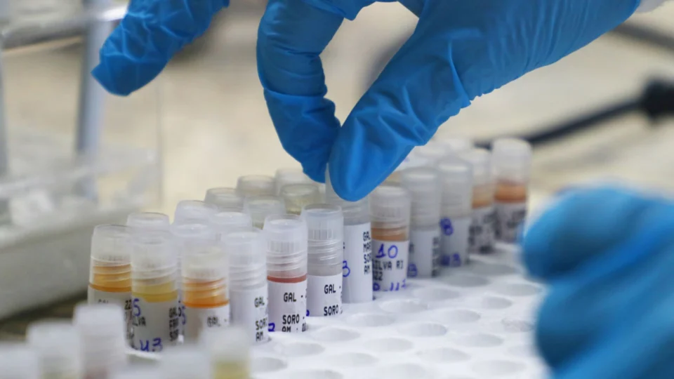 Mpox: Amazonas confirma 4 notificações de casos suspeitos da Varíola Símia