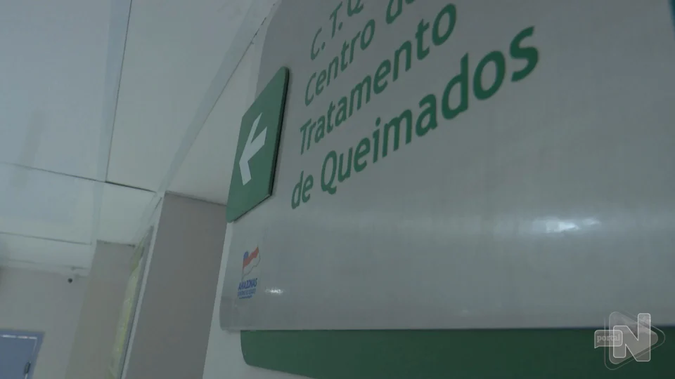 VÍDEO: acidentes domésticos provocam metade dos casos de queimaduras no AM