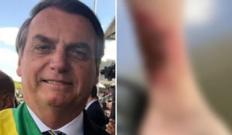 Carlos Bolsonaro diz que presidente está em recuperação de ferimento na perna