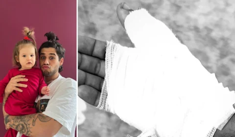 Cantor Zé Felipe sofre acidente doméstico e leva pontos na mão e no braço