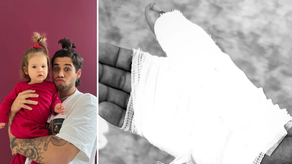 Cantor Zé Felipe sofre acidente doméstico e leva pontos na mão e no braço