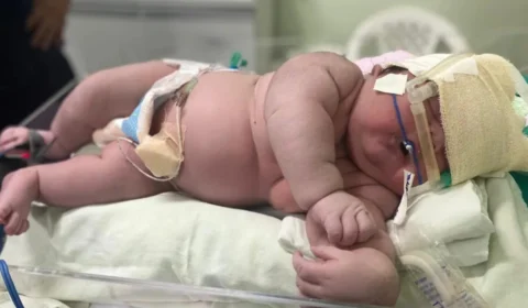 Bebê nasce com mais de 7 kg em maternidade de Parintins, no AM