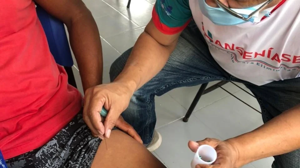 Hanseníase: Fuham faz mutirão para detectar doença no sábado, 28, em Manaus