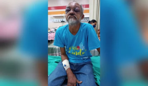 Hospital procura familiares de idoso atropelado por ônibus em Manaus