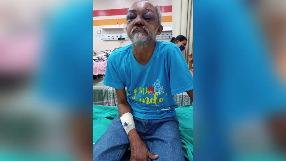 Hospital procura familiares de idoso atropelado por ônibus em Manaus