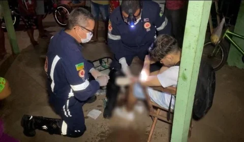 Motociclista perde dedo em acidente de trânsito em Boa Vista-RR