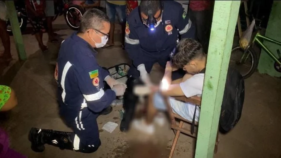 Motociclista perde dedo em acidente de trânsito em Boa Vista-RR